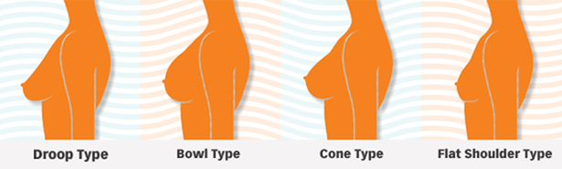 Cones and bells or various shapes of women's breasts 